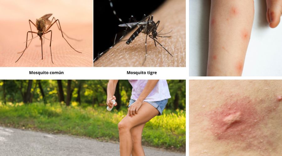 Picadura mosquitos